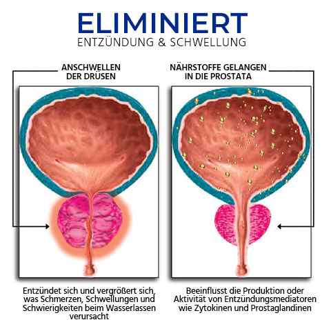 Oveallgo™ BeeProsta Nasenspray für die Prostatagesundheit