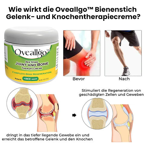 Oveallgo™ Bee Sting Gelenk- und Knochentherapiecreme – vollständige Körperregeneration