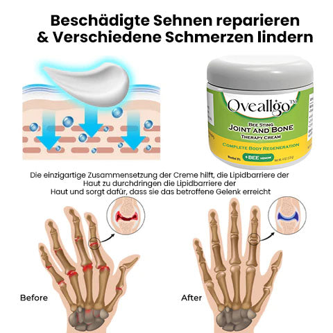 Oveallgo™ Bee Sting Gelenk- und Knochentherapiecreme – vollständige Körperregeneration