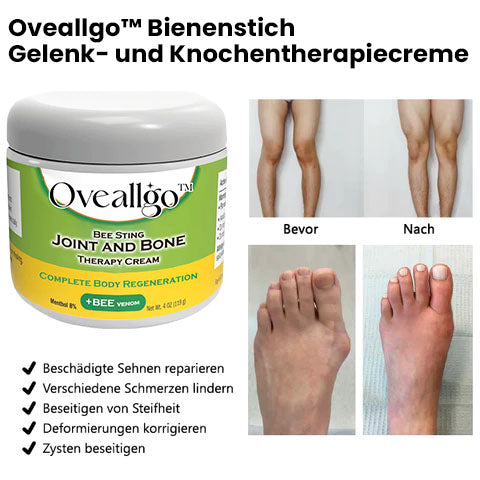 Oveallgo™ Bee Sting Gelenk- und Knochentherapiecreme – vollständige Körperregeneration