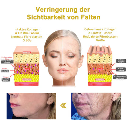 💞😍Letzter Tag Rabatt : 𝟕5% OFF🫧Oveallgo™ Erweiterte Straffende Faltenreduzierende Creme (Elastizität der Haut wiederherstellen)🌐