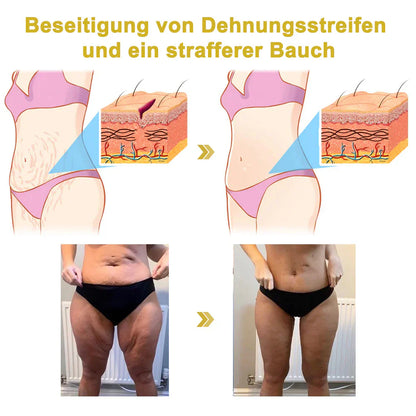 💞😍Letzter Tag Rabatt : 𝟕5% OFF🫧Oveallgo™ Erweiterte Straffende Faltenreduzierende Creme (Elastizität der Haut wiederherstellen)🌐